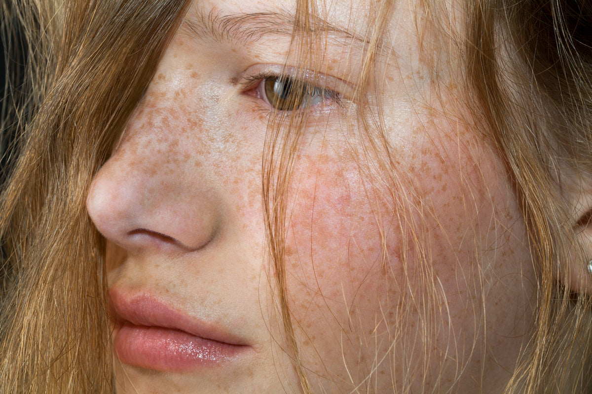 Gesicht einer Frau mit Sommersprossen und einzelnen Haarsträhnen